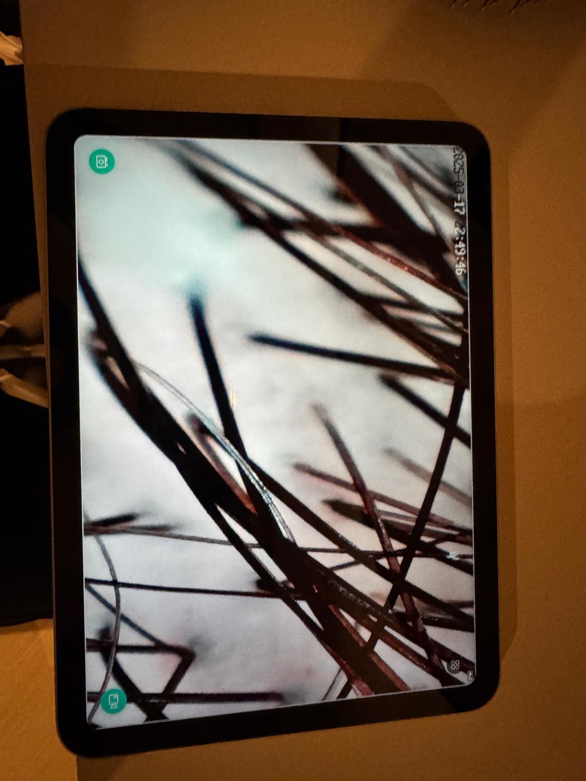 Hoofdharen scan na een behandeling