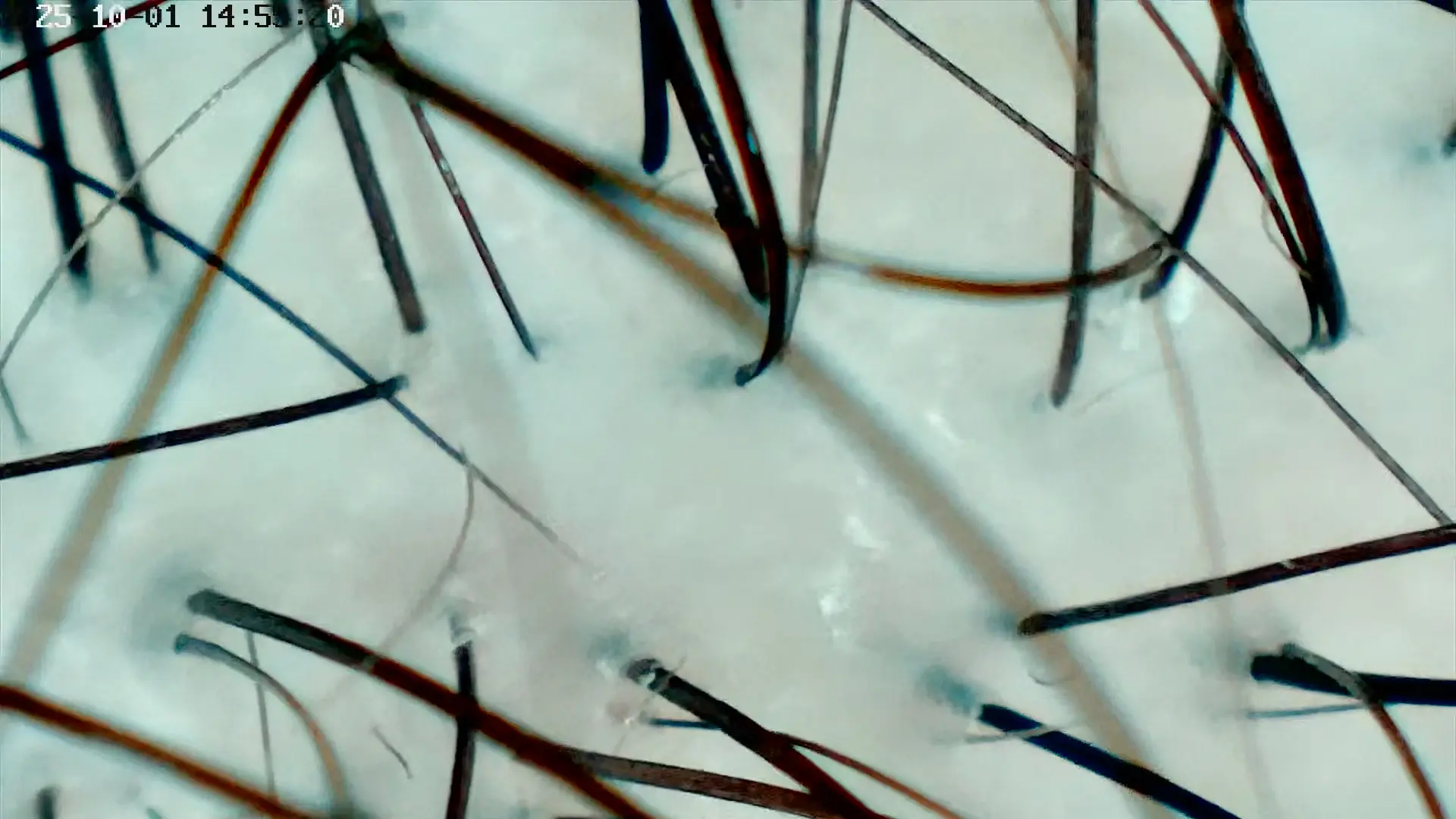 Hoofdharen scan na een behandeling